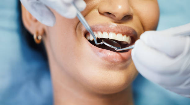 Best Broken or Chipped Tooth Repair in Gray, TN